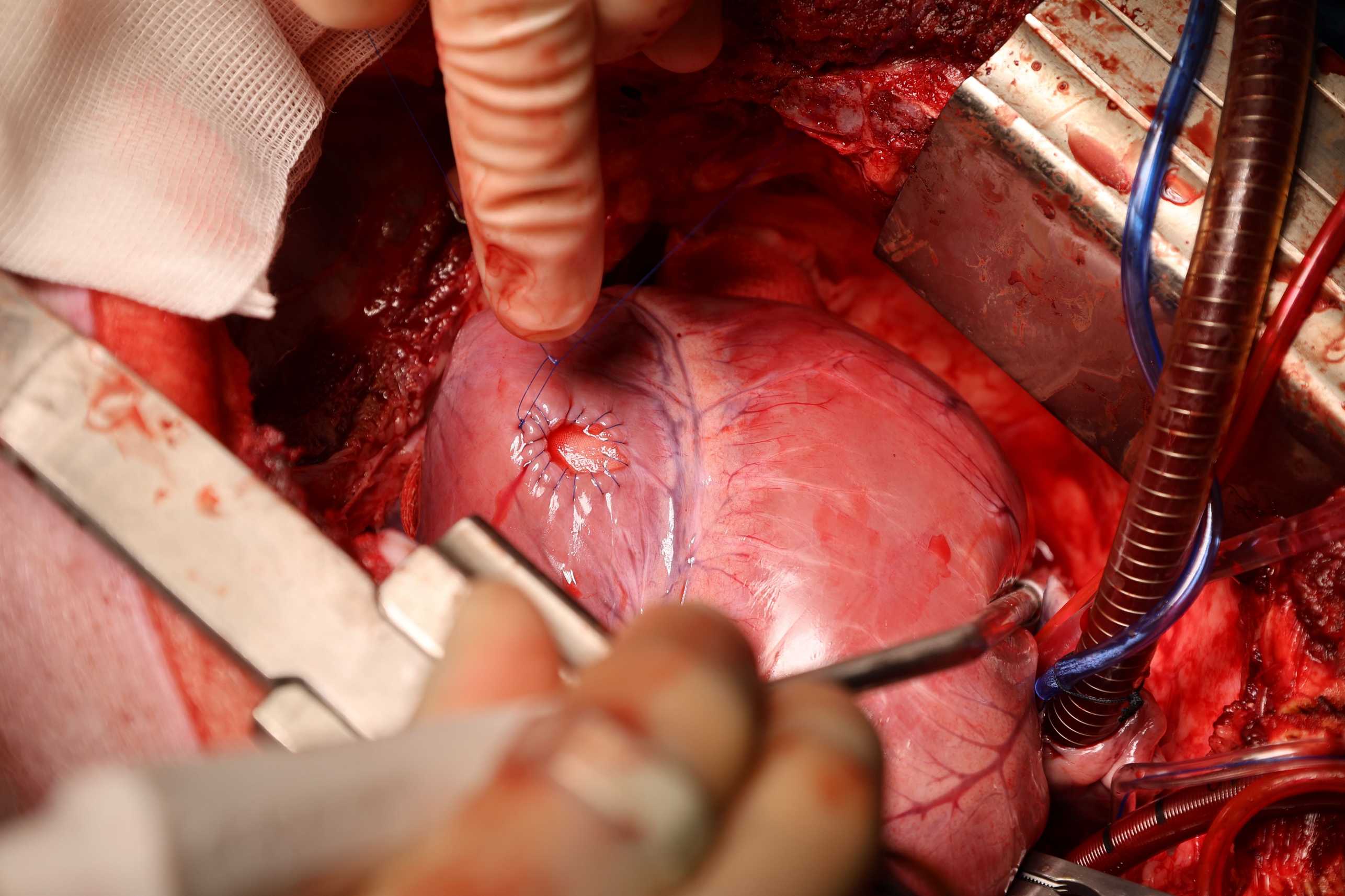 Filamented Light Biofabrication with Cardiomyocytes